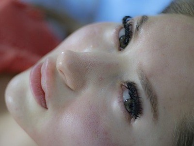 Trądzik różowaty a kosmetyki naturalne